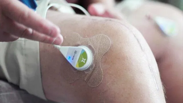 Wearable Ultrasound